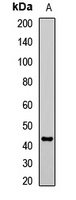 Anti-AGXT1 Antibody
