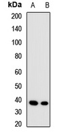 ALAD antibody