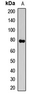 Anti-FANCE Antibody