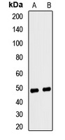 Anti-Ferrochelatase Antibody