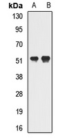 Anti-GTF2H4 Antibody