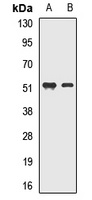 Anti-MEIS2 Antibody