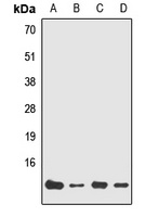 Anti-NDUFA7 Antibody