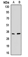 Anti-PDC Antibody