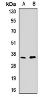 PDC antibody