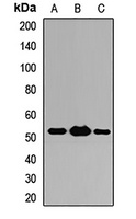 Anti-ST13 Antibody