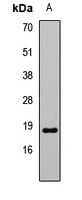 Anti-Tim17B Antibody