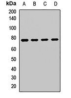 Anti-DFS70 Antibody