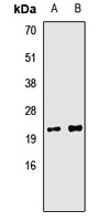 Anti-Tim9B Antibody