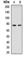 Anti-PPP2R3B Antibody