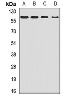 Anti-SMEK1 Antibody