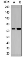 Anti-RARS2 Antibody
