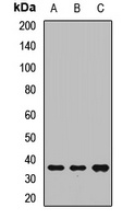 Anti-TEFM Antibody