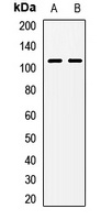 NAA25 antibody