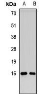 RMI2 antibody