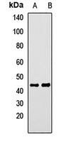 Anti-CALCRL Antibody