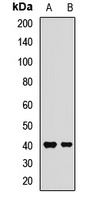 Anti-FcRn Antibody