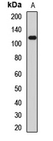 Anti-TRPA1 Antibody