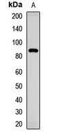 Anti-TMC1 Antibody