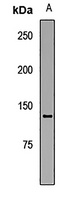 Anti-HFM1 Antibody