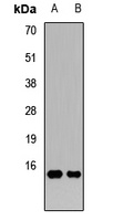 Anti-GATC Antibody