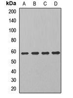 ALDH7A1 antibody