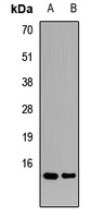 TAX1BP3 antibody