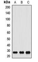 Anti-CACYBP Antibody