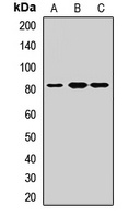 Anti-BBS10 Antibody