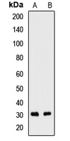 SNRPB2 antibody