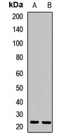 Anti-Prefoldin 3 Antibody