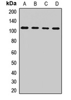 Anti-TFIP1 Antibody