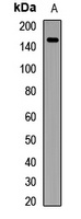 Anti-SARA Antibody