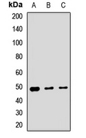 Anti-GCDH Antibody
