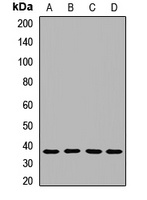 Anti-NAGK Antibody
