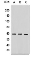 Anti-MGAT2 Antibody