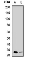Anti-EXOSC4 Antibody