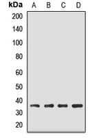 EBNA1BP2 antibody