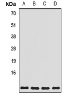 Anti-ATP5L Antibody