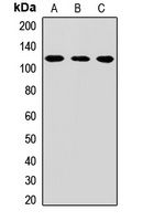 Anti-CPSF2 Antibody
