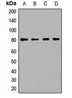 Anti-PCCA Antibody