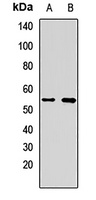 ME2 antibody