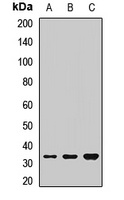 Anti-PHOX2B Antibody