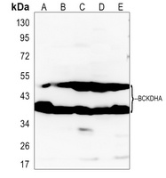 Anti-BCKDHA Antibody