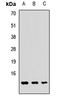 Anti-GUCA2A Antibody