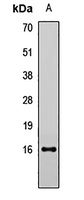 Anti-LCN1 Antibody