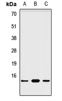 Anti-NDUFA6 Antibody