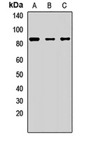 Anti-RNase L Antibody