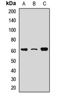 Anti-RPE65 Antibody