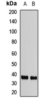 Anti-FBP2 Antibody